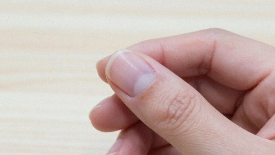 Dlaczego skórka pod paznokciem przerasta?